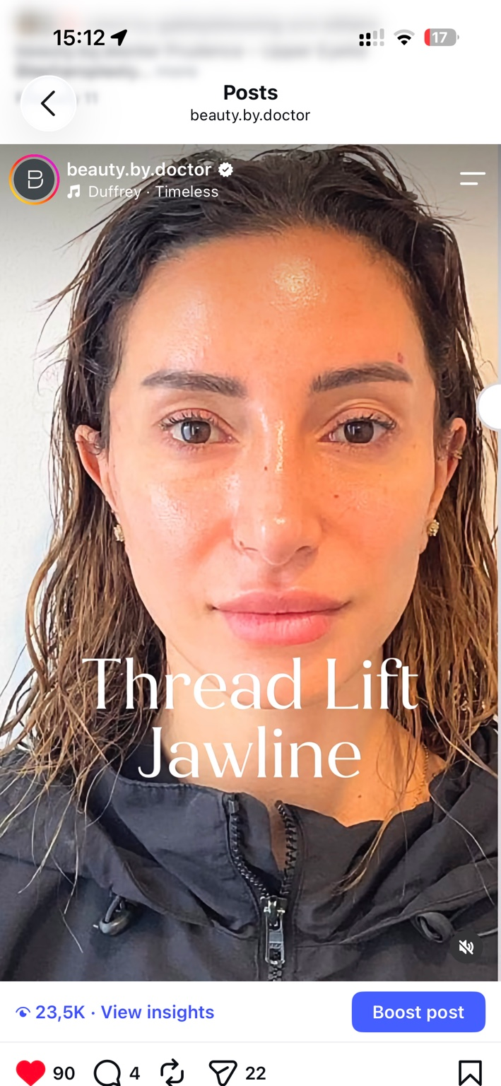 Thread Lift Reel